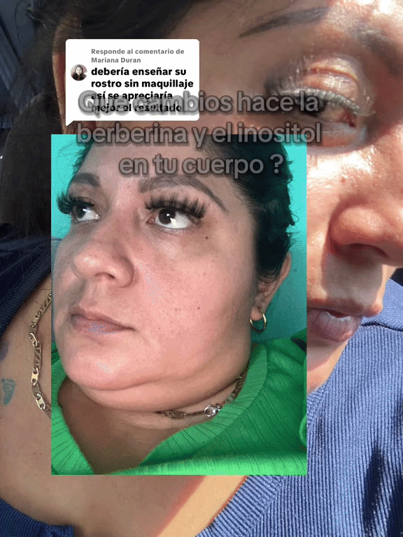 Berberina apoyo al metabolismo de la glucosa